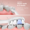 image:imageAquaSonic Home Dental Center PRO  Brushing amp Flossing Made Easy  Brush amp Floss  Power Toothbrush amp Water Flosser  Whiter Teeth amp Healthier Gums  Black Series ProOral IrrigatorRose Gold