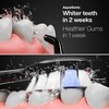 image:imageAquaSonic Home Dental Center PRO  Brushing amp Flossing Made Easy  Brush amp Floss  Power Toothbrush amp Water Flosser  Whiter Teeth amp Healthier Gums  Black Series ProOral IrrigatorBlack